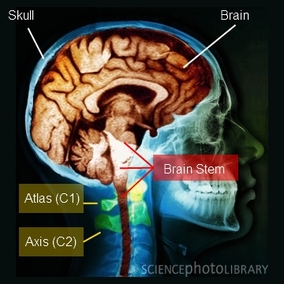 brain_stem_and_the_upper_neck