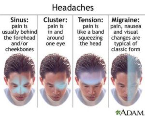 types of headaches