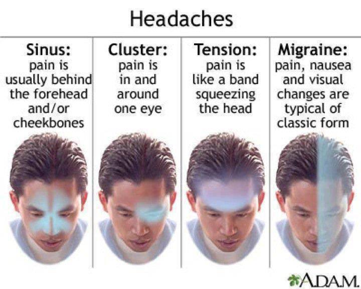 natural-solutions-for-headaches